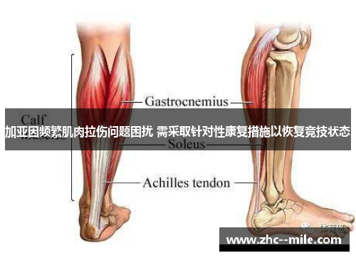加亚因频繁肌肉拉伤问题困扰 需采取针对性康复措施以恢复竞技状态 加亚因频繁肌肉拉伤问题困扰 需采取针对性康复措施以恢复竞技状态